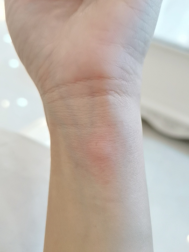 破伤风症状