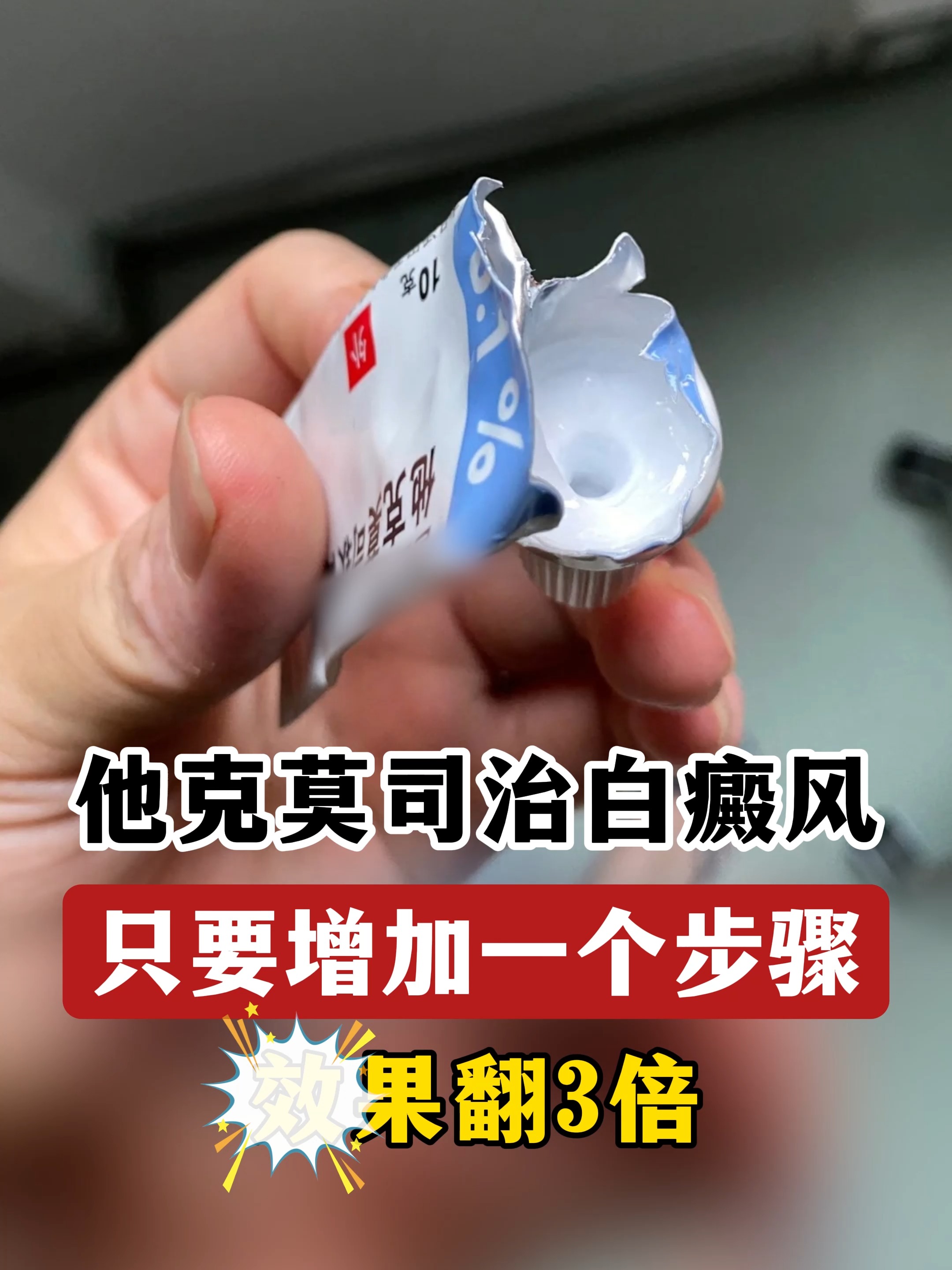 白癜风能治好吗