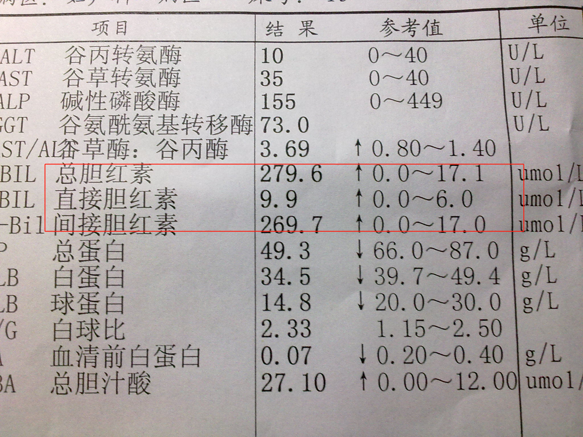 间接胆红素高是什么意思