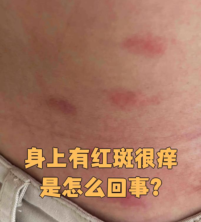 浑身痒是怎么回事