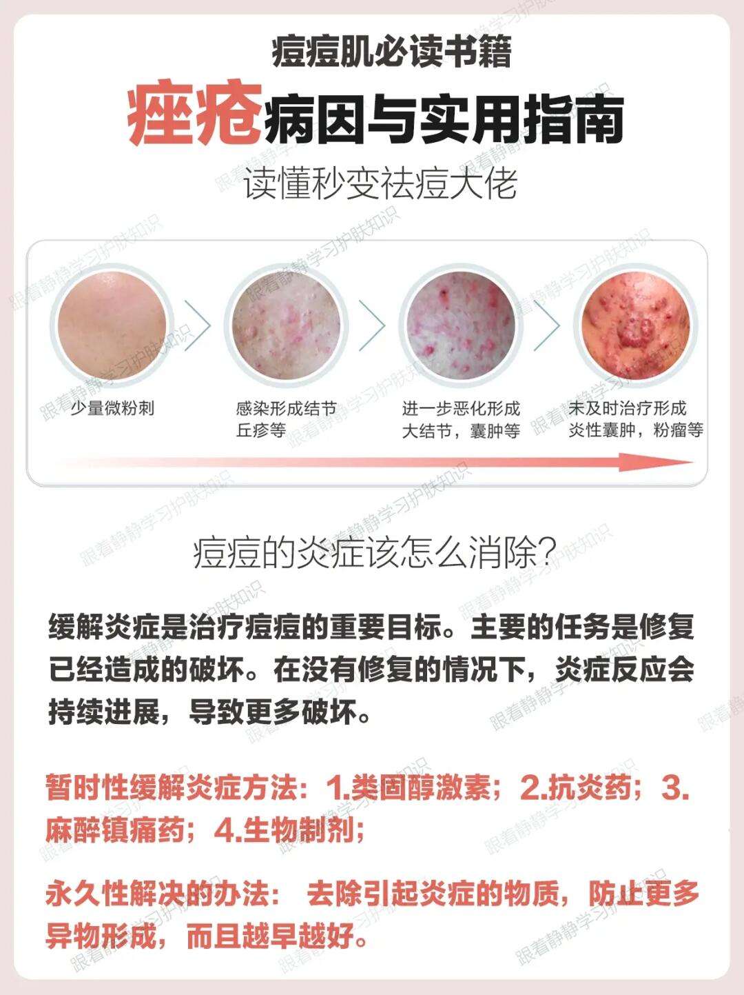 青春痘囊肿怎么治疗