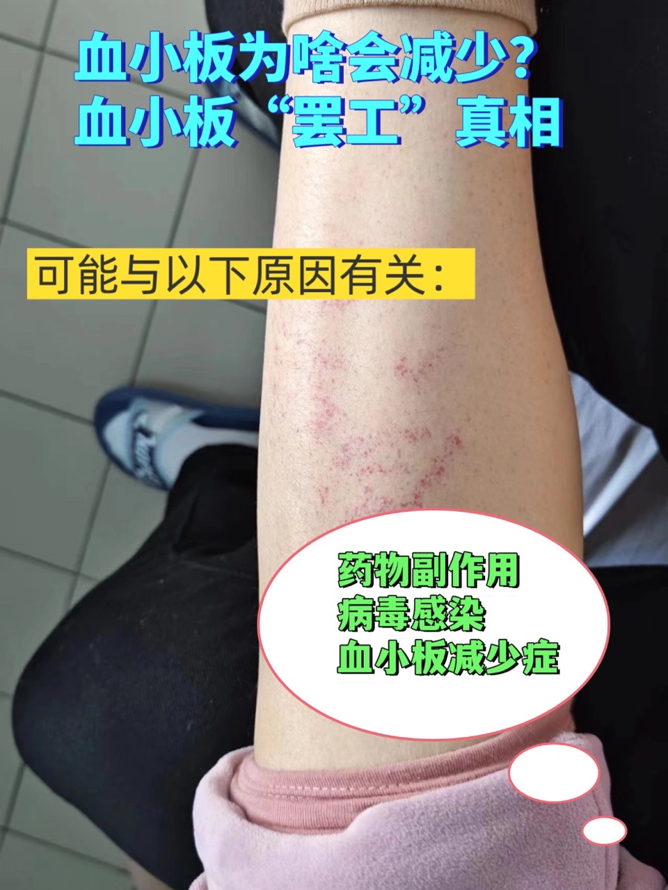 血小板低是怎么回事?