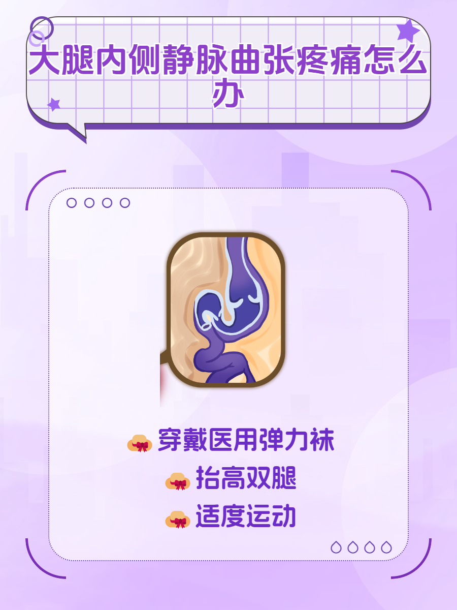 如何有效的治疗静脉曲张