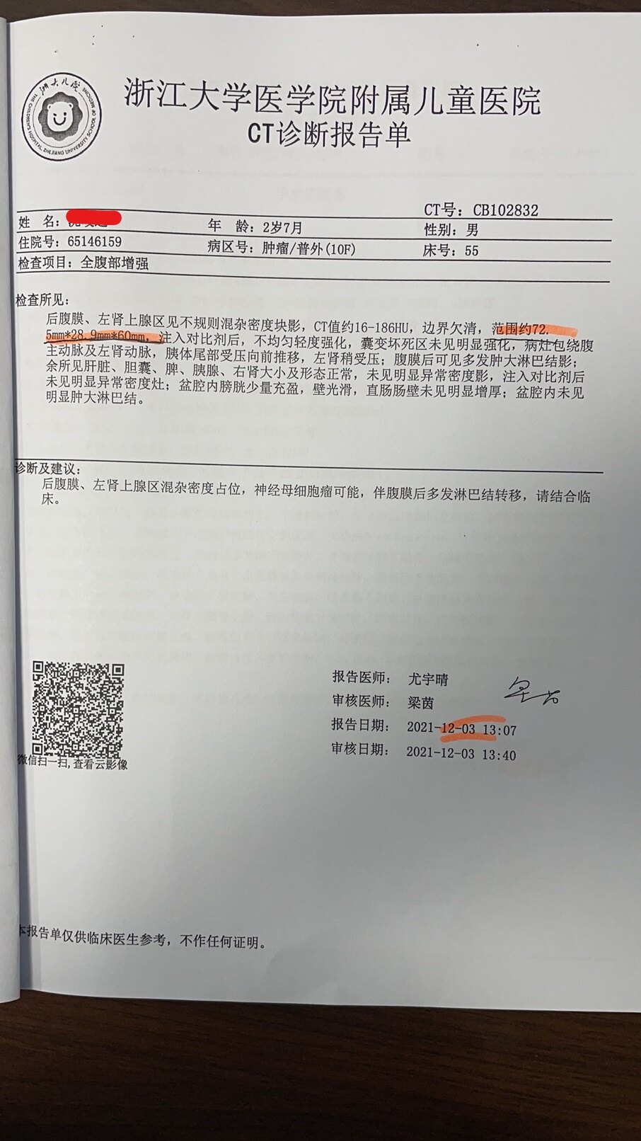 神经母细胞瘤是什么病