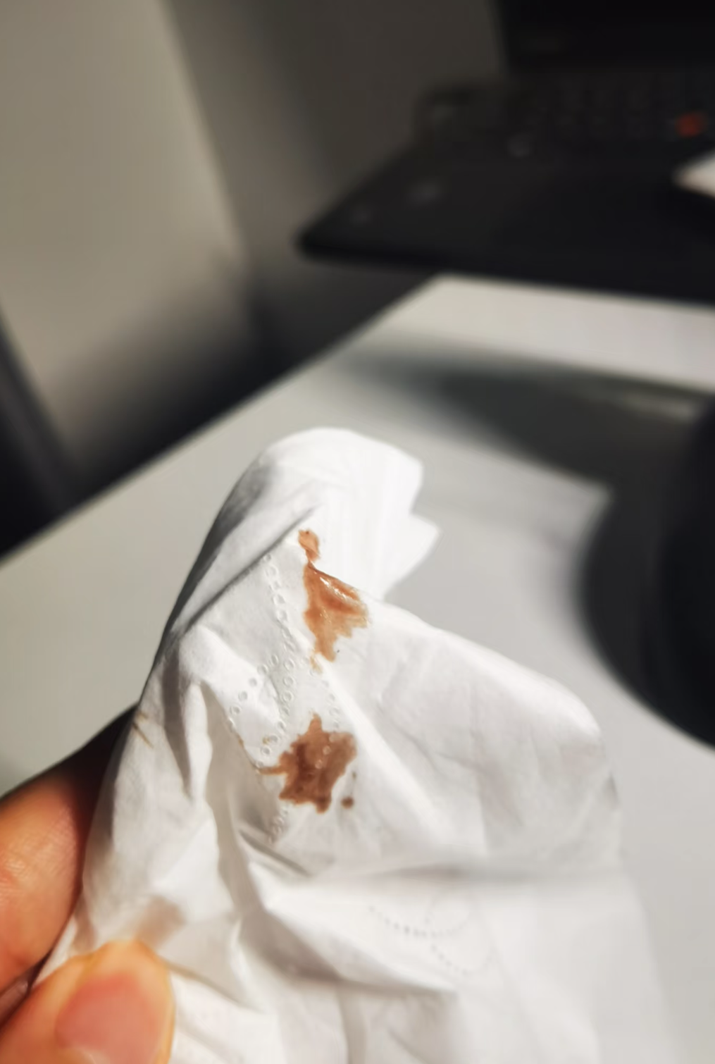 排卵期白带有血丝是正常的吗