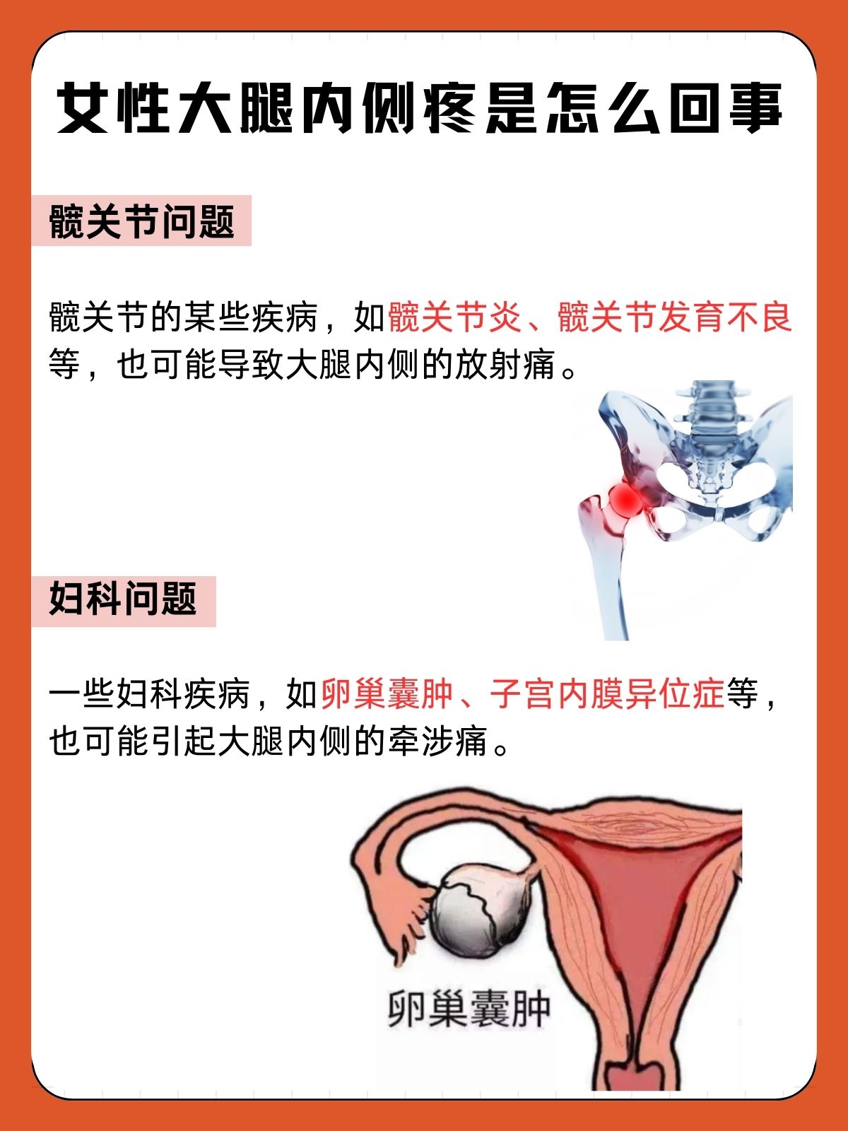 左大腿根内侧疼怎么回事