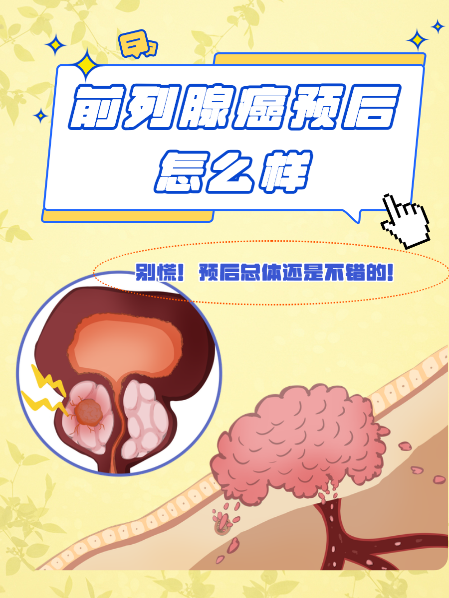 前列腺癌能活多久