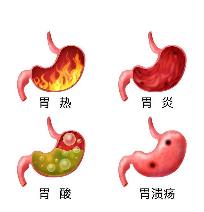 胃溃疡的症状有哪些表现