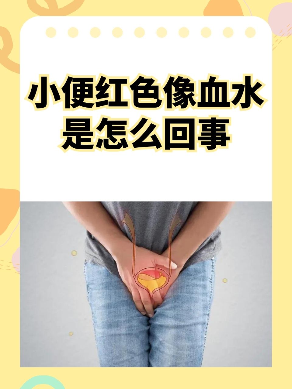 尿液中带血是什么回事?