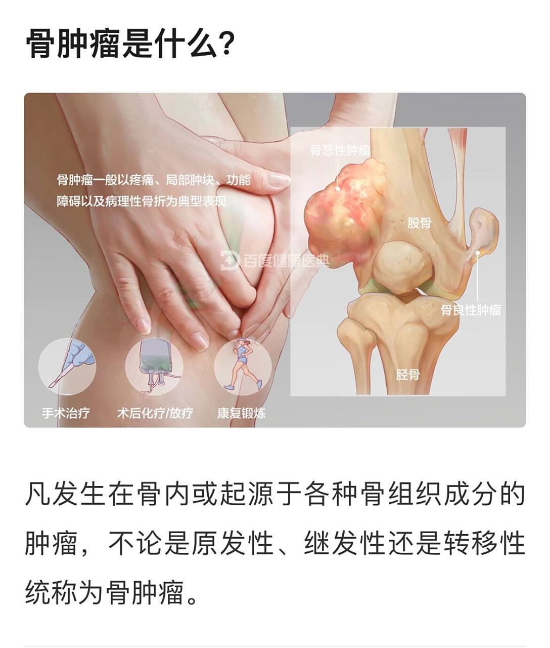 骨转移瘤是骨癌吗?