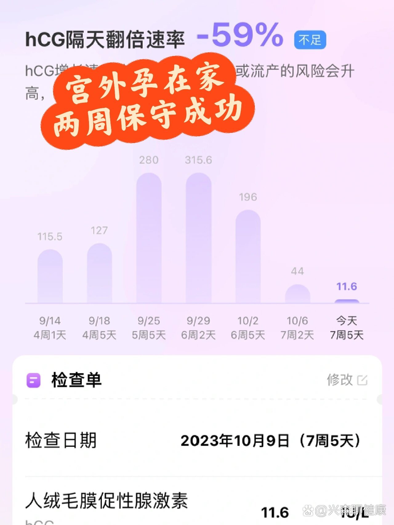 宫外孕几率大吗
