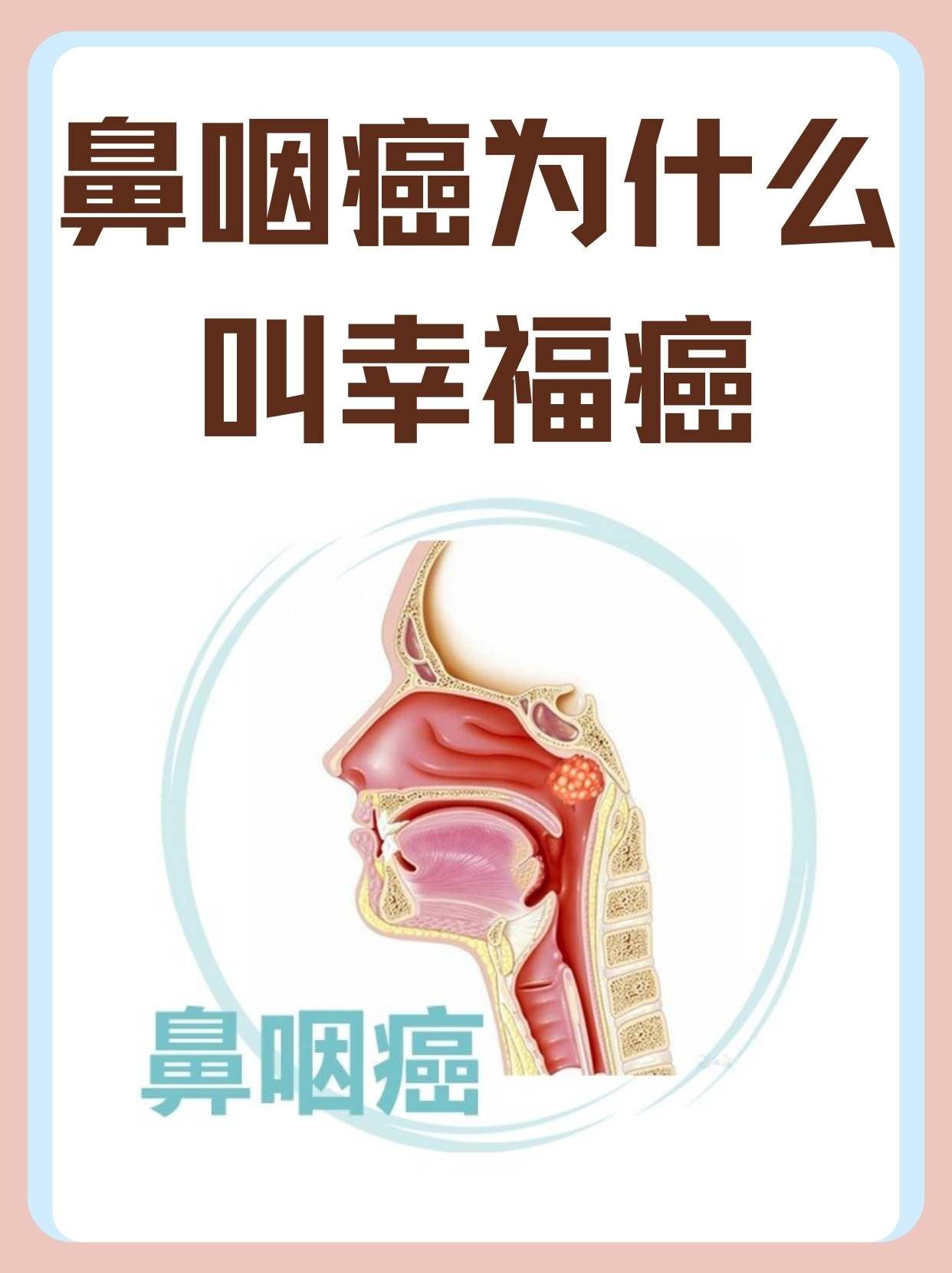 鼻癌的症状有哪些怎么知道自己有鼻癌