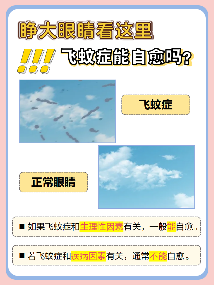 眼睛出现飞蚊怎么办?
