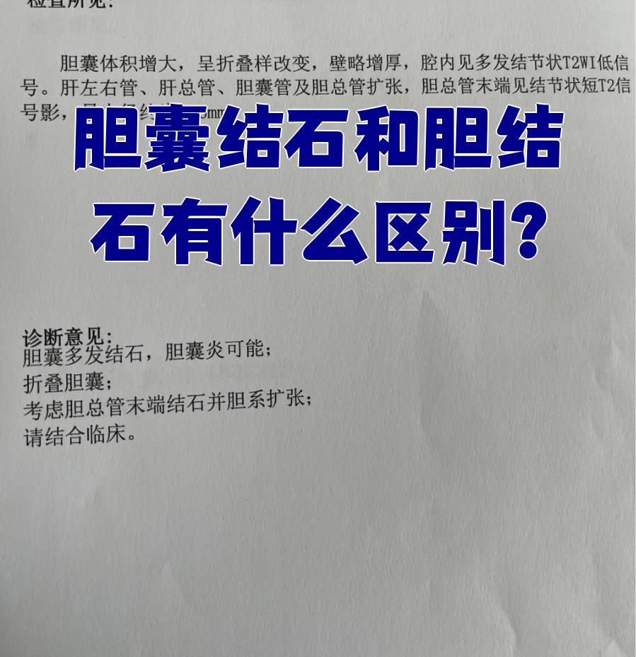 胆管结石的症状是什么