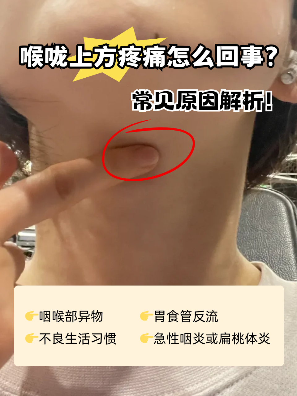 嗓子感觉有异物怎么回事