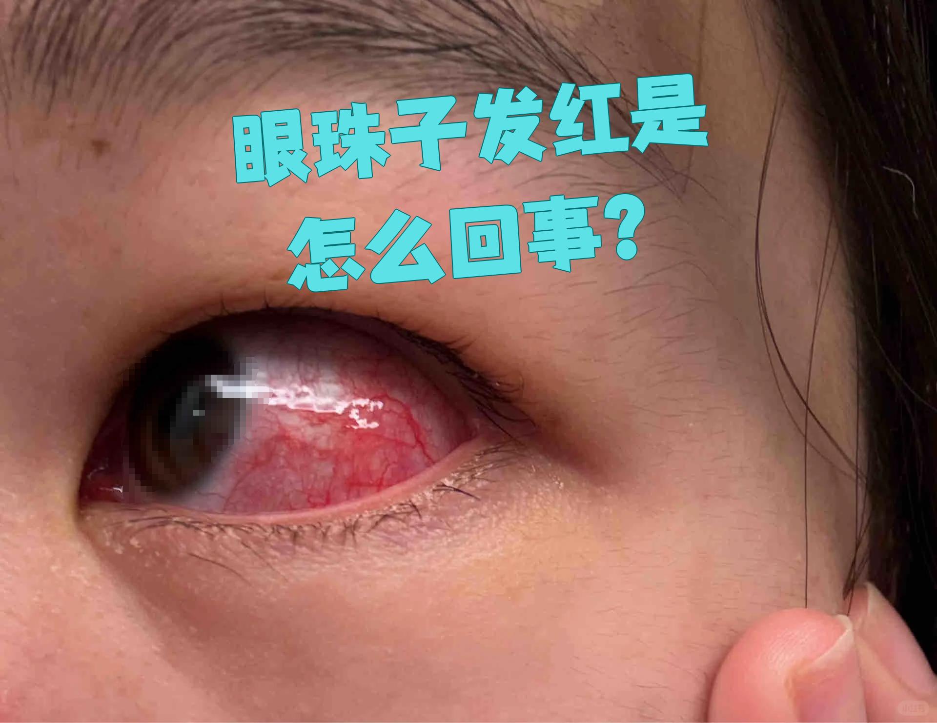 最近眼睛有点疼是怎么回事?
