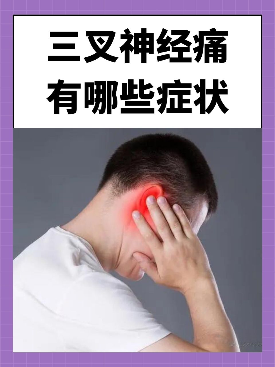 三叉神经痛怎么根治