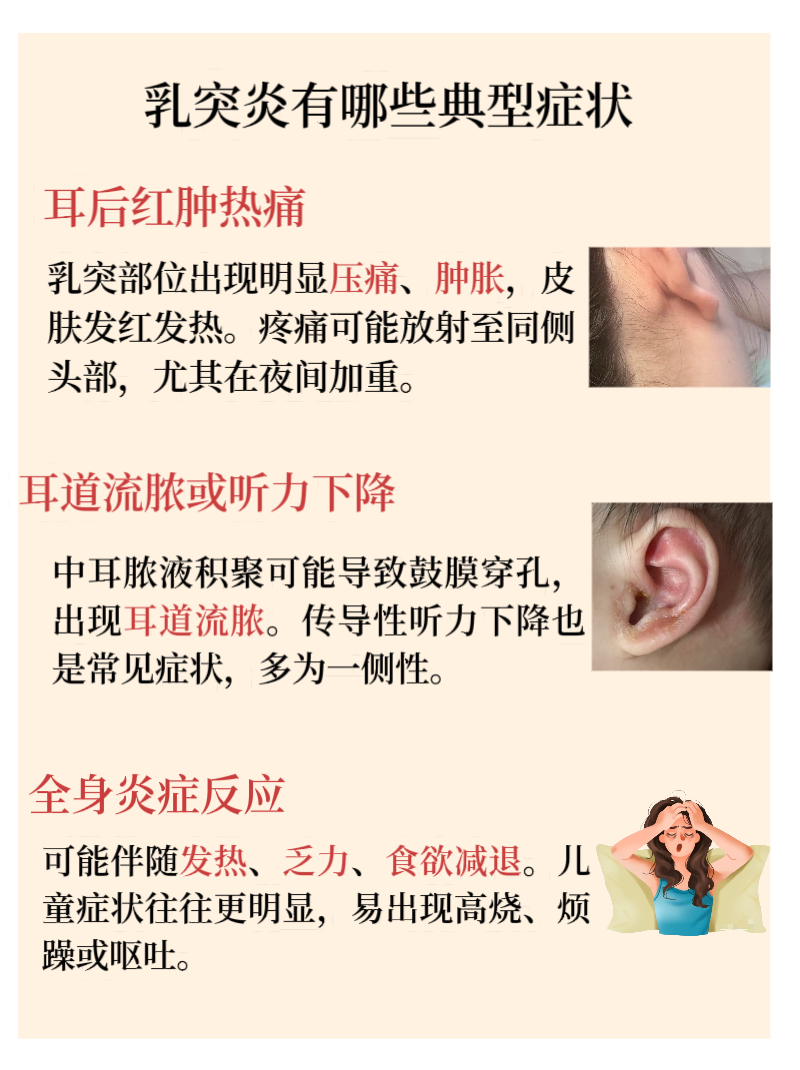 中耳乳突炎有哪些症状?