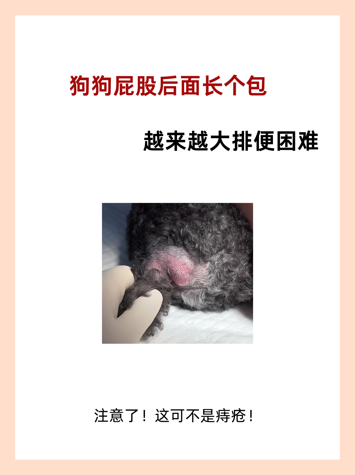 屁股上长了个疙瘩怎么办