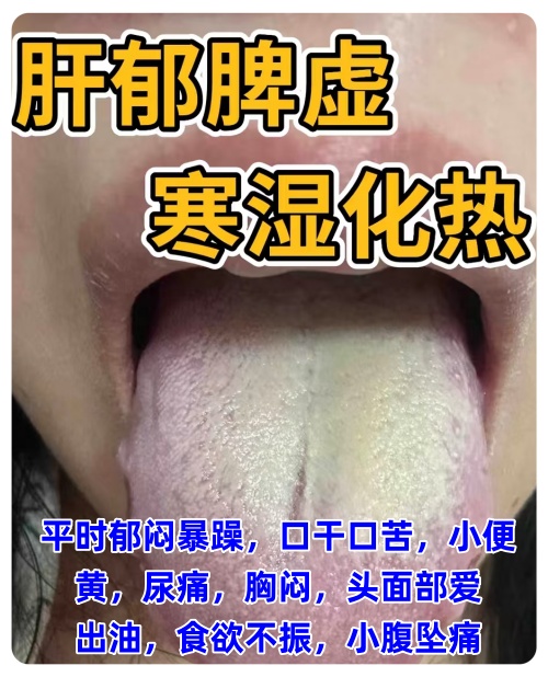 脾肾两虚有什么表现
