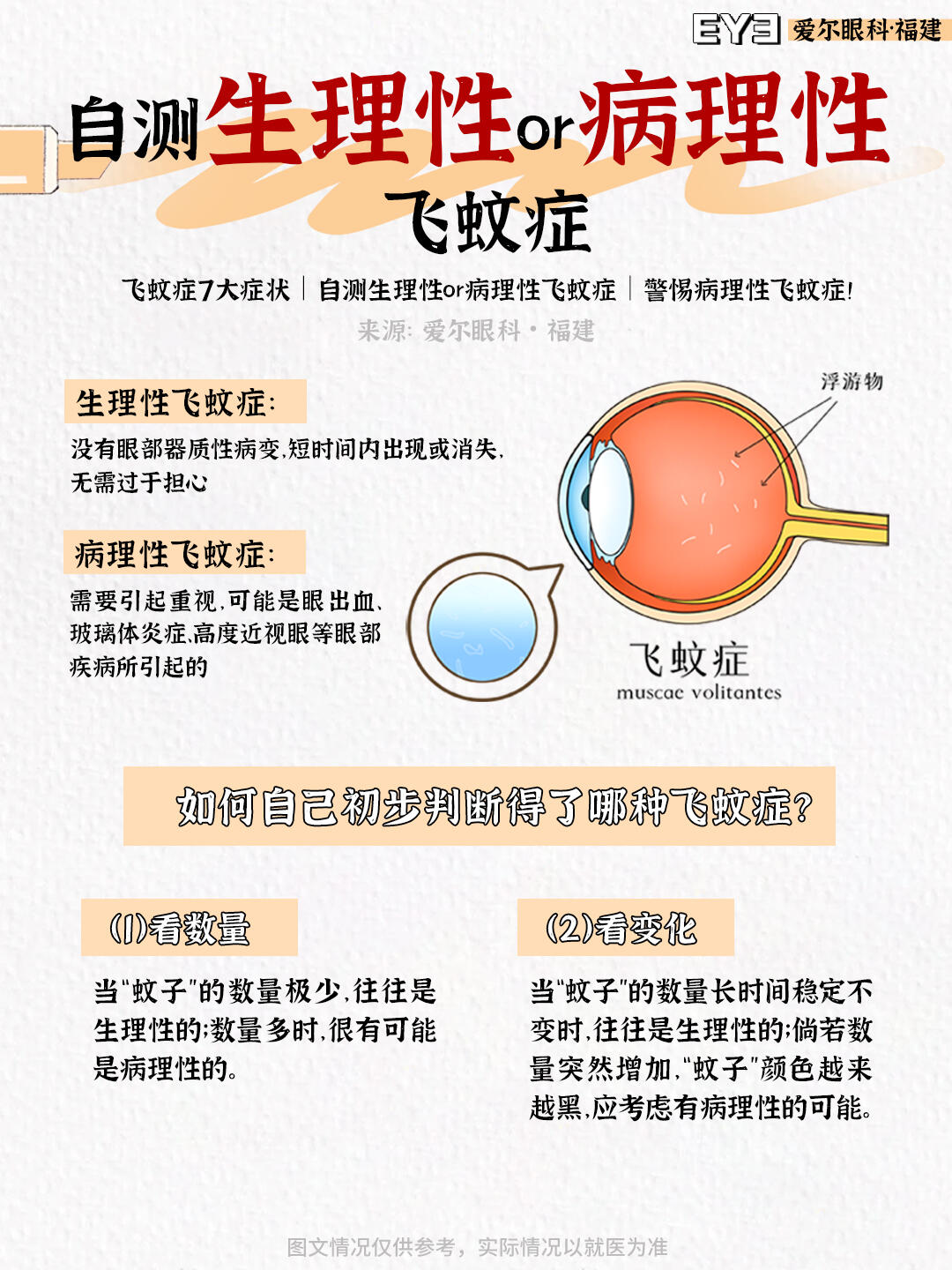 飞蚊症是什么原因