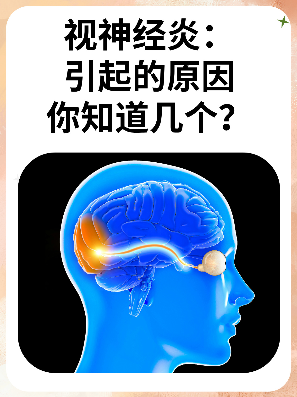 视神经脊髓炎能治愈吗