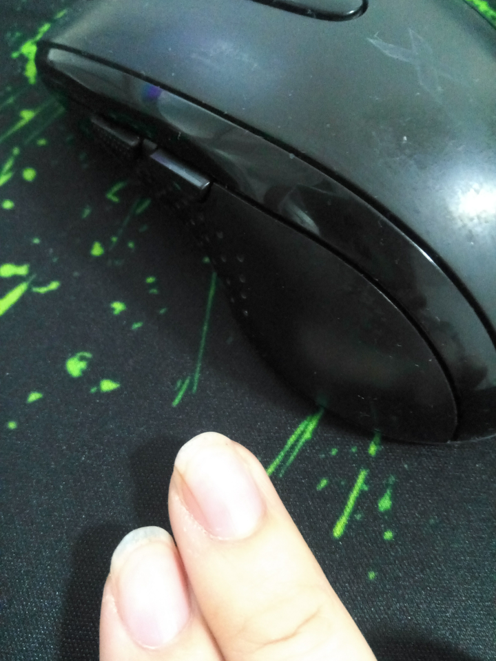 手指甲上有黑色竖纹怎么回事