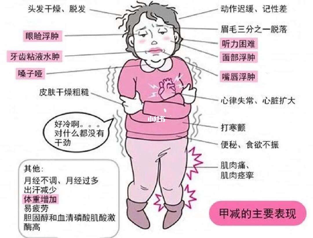 甲减症状有哪些