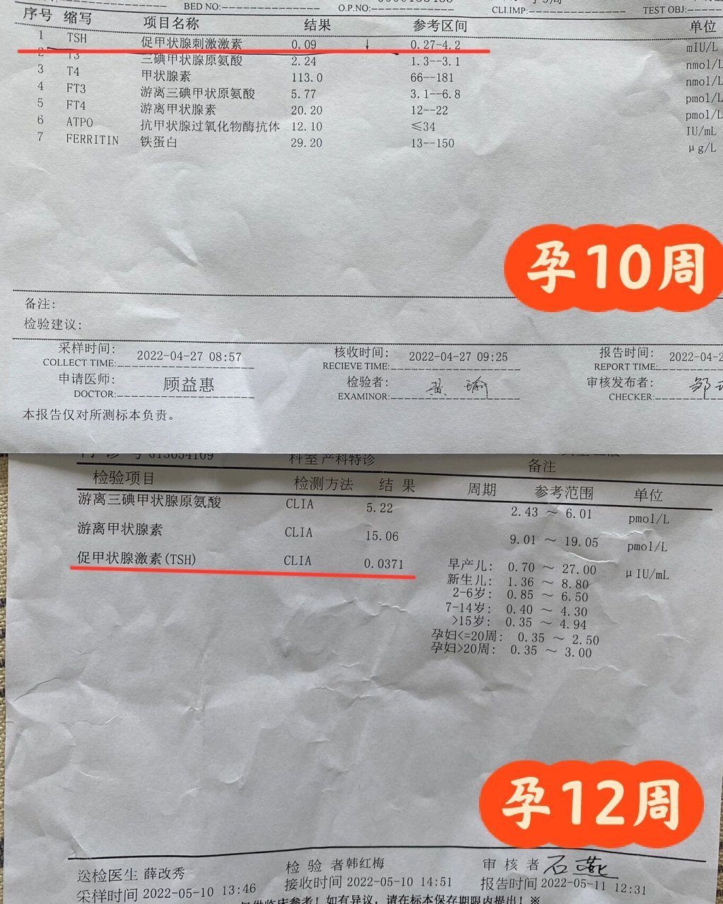 TSH标准是多少正常