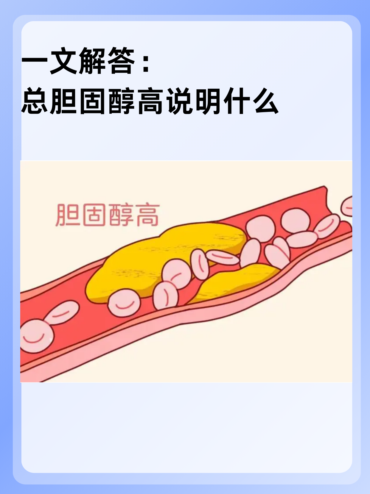 总胆固醇偏高的危害是什么