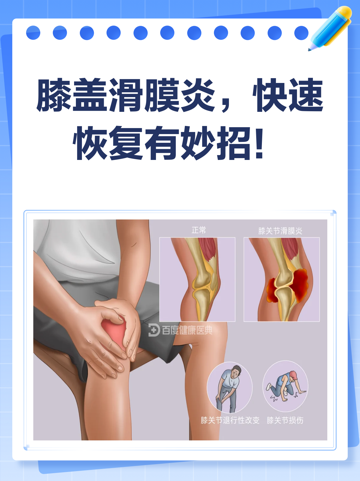 膝关节滑膜炎怎么锻炼