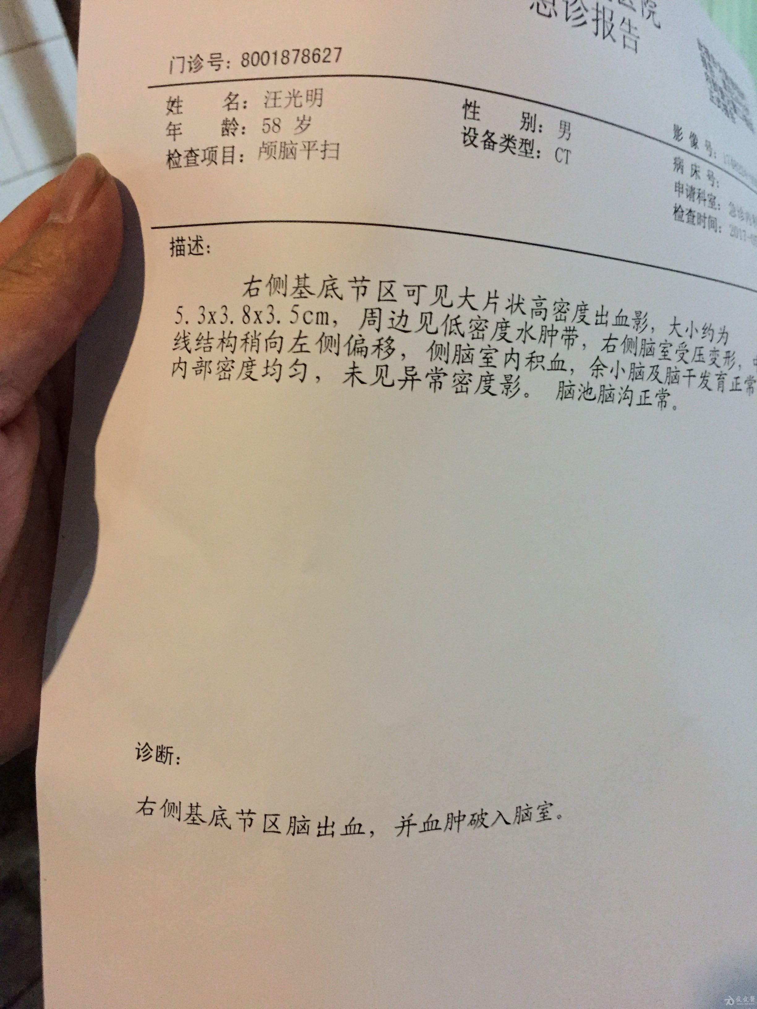 开颅手术后几天过危险期