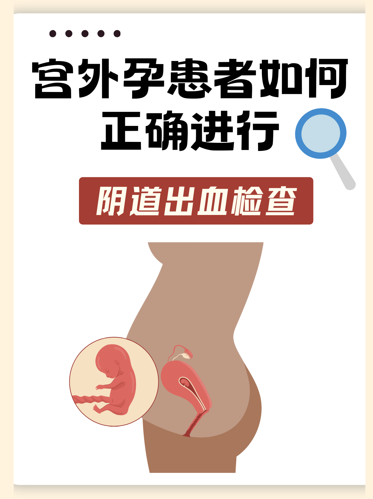 宫外孕的原因