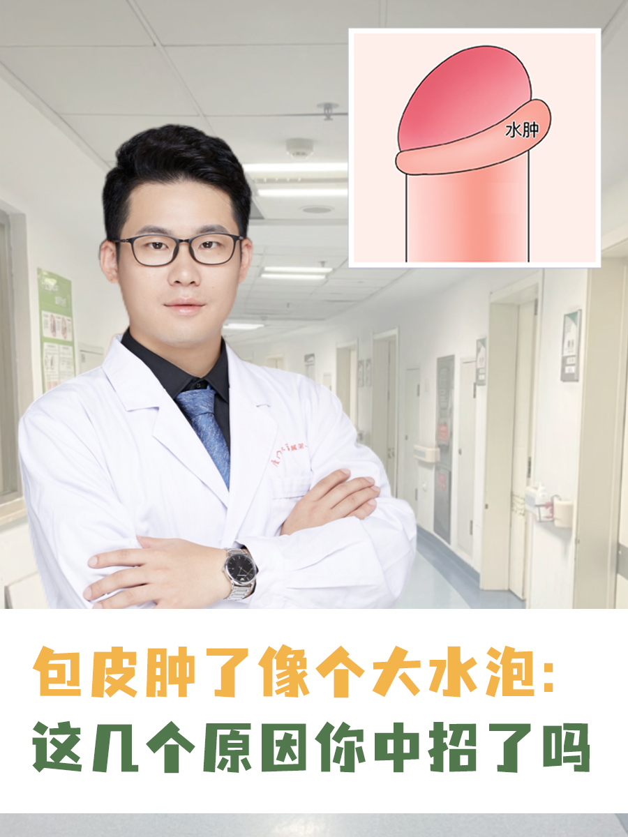 包皮手术后出现水肿怎么办?