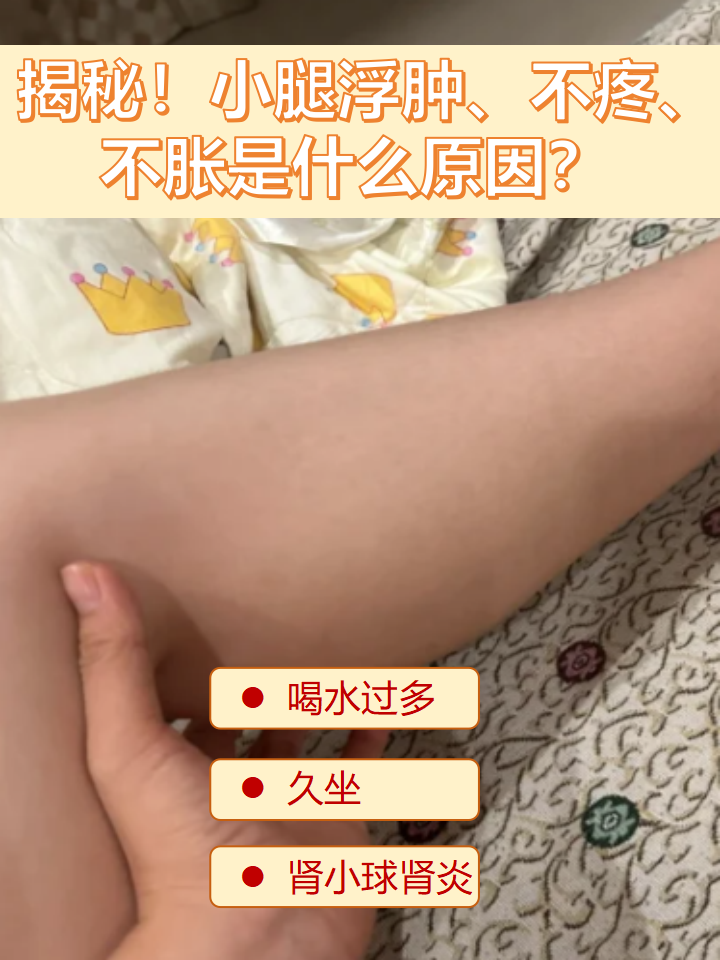 小腿浮肿是什么原因?