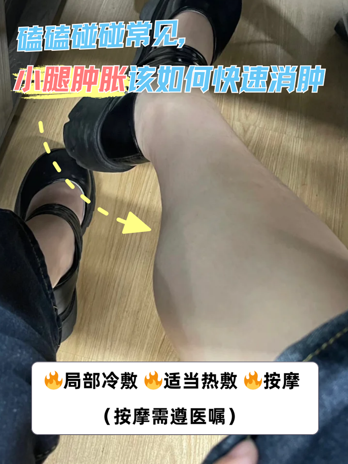 小腿浮肿是什么原因?