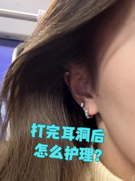 耳洞发炎消毒后耳钉带不上