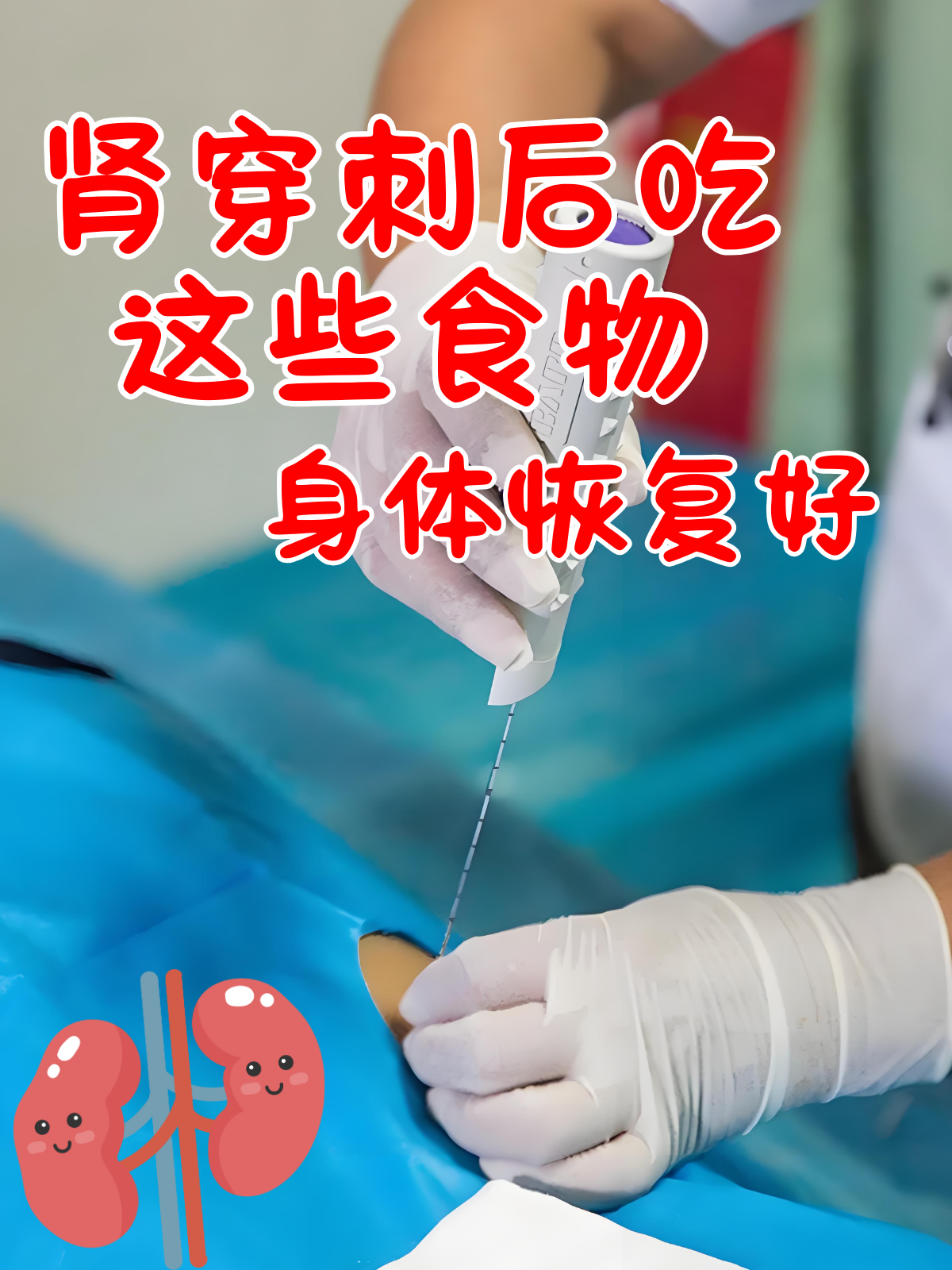 什么是肾穿刺?