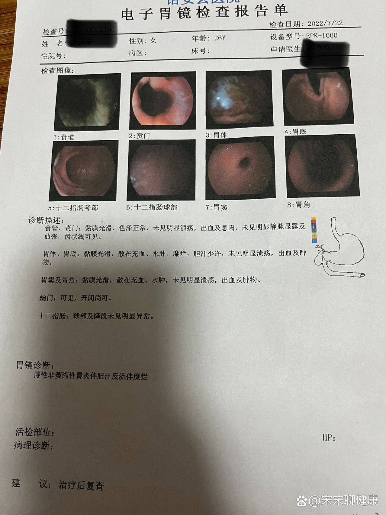 电子胃镜能检查什么疾病