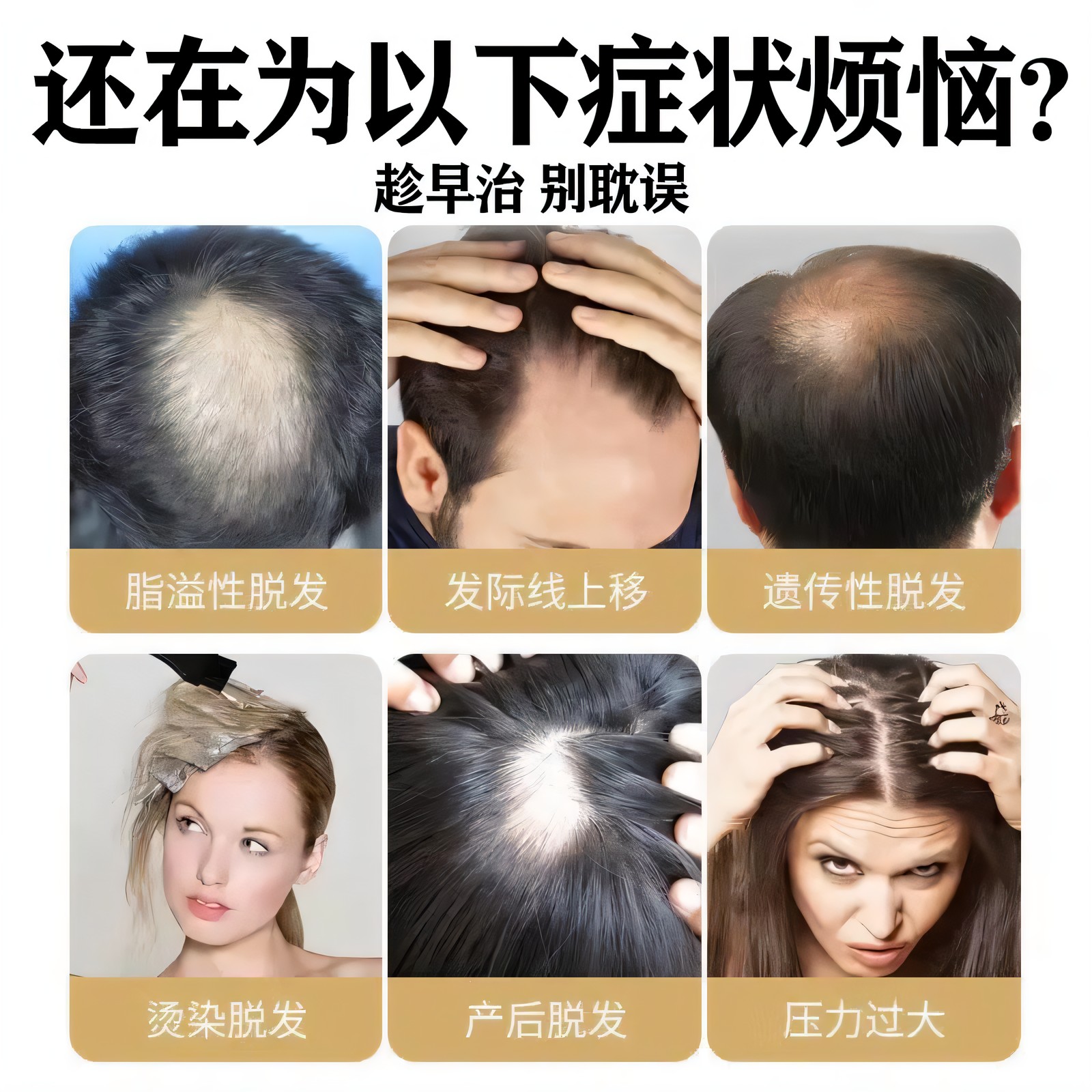 肾虚导致的脱发能恢复吗