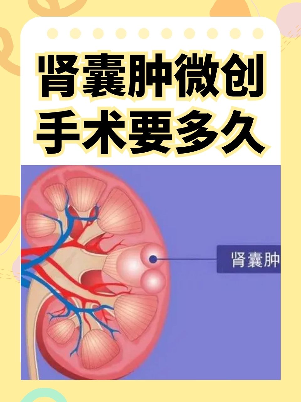 肾脏囊肿是怎么引起的