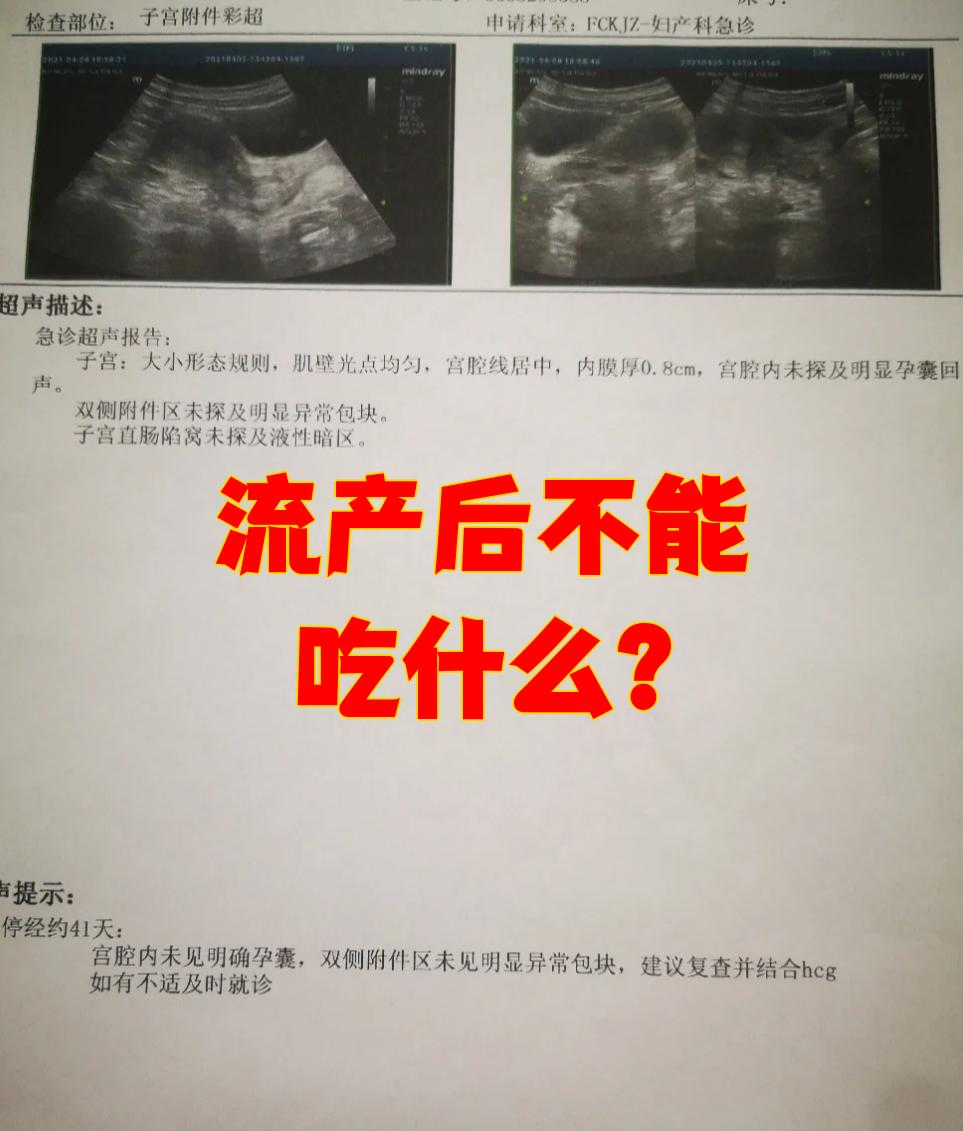 流产后不能吃什么
