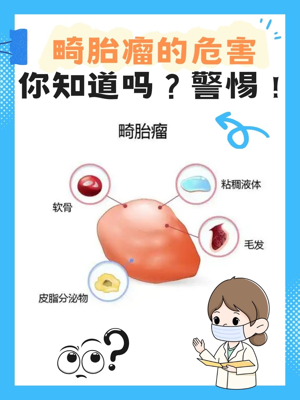 卵巢畸胎瘤有什么危害