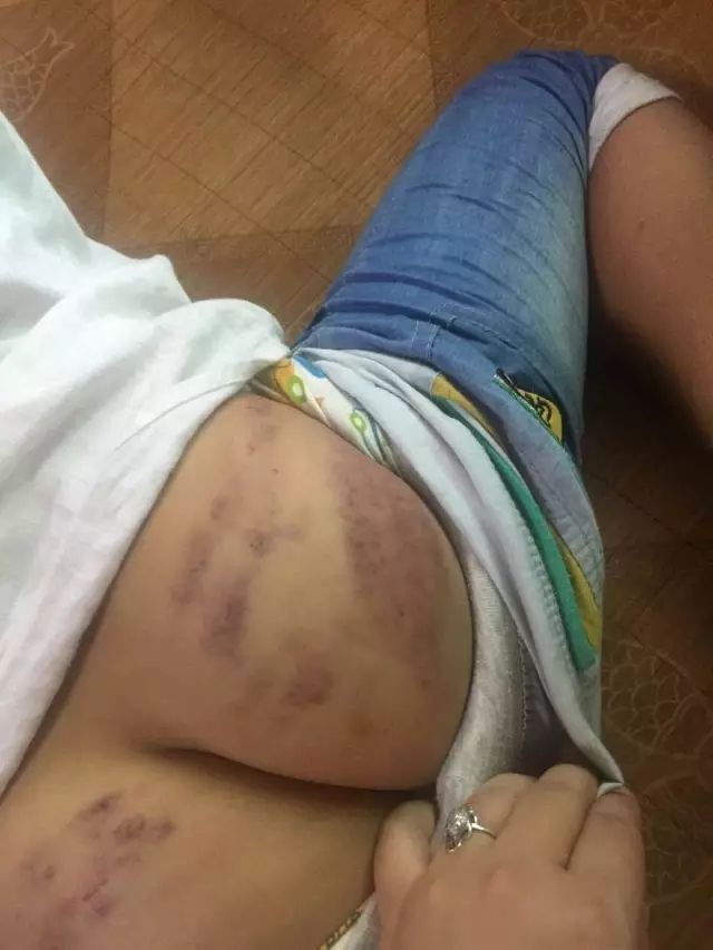 十一岁男孩,我用衣服挂打他屁股
