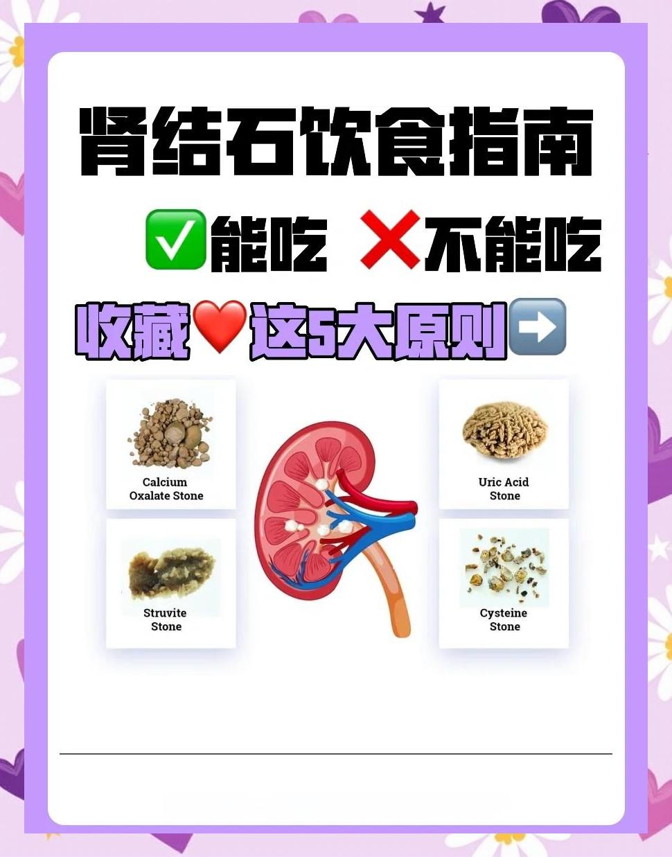 肾结石吃什么好?