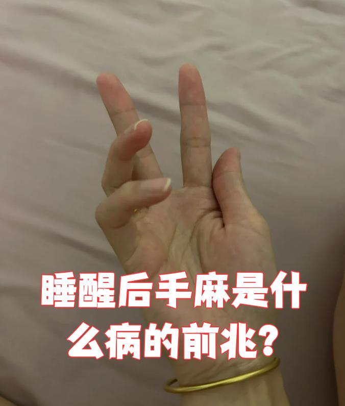 睡觉醒来手麻是怎么回事