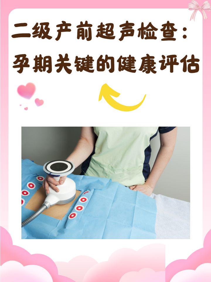 超声检查是什么