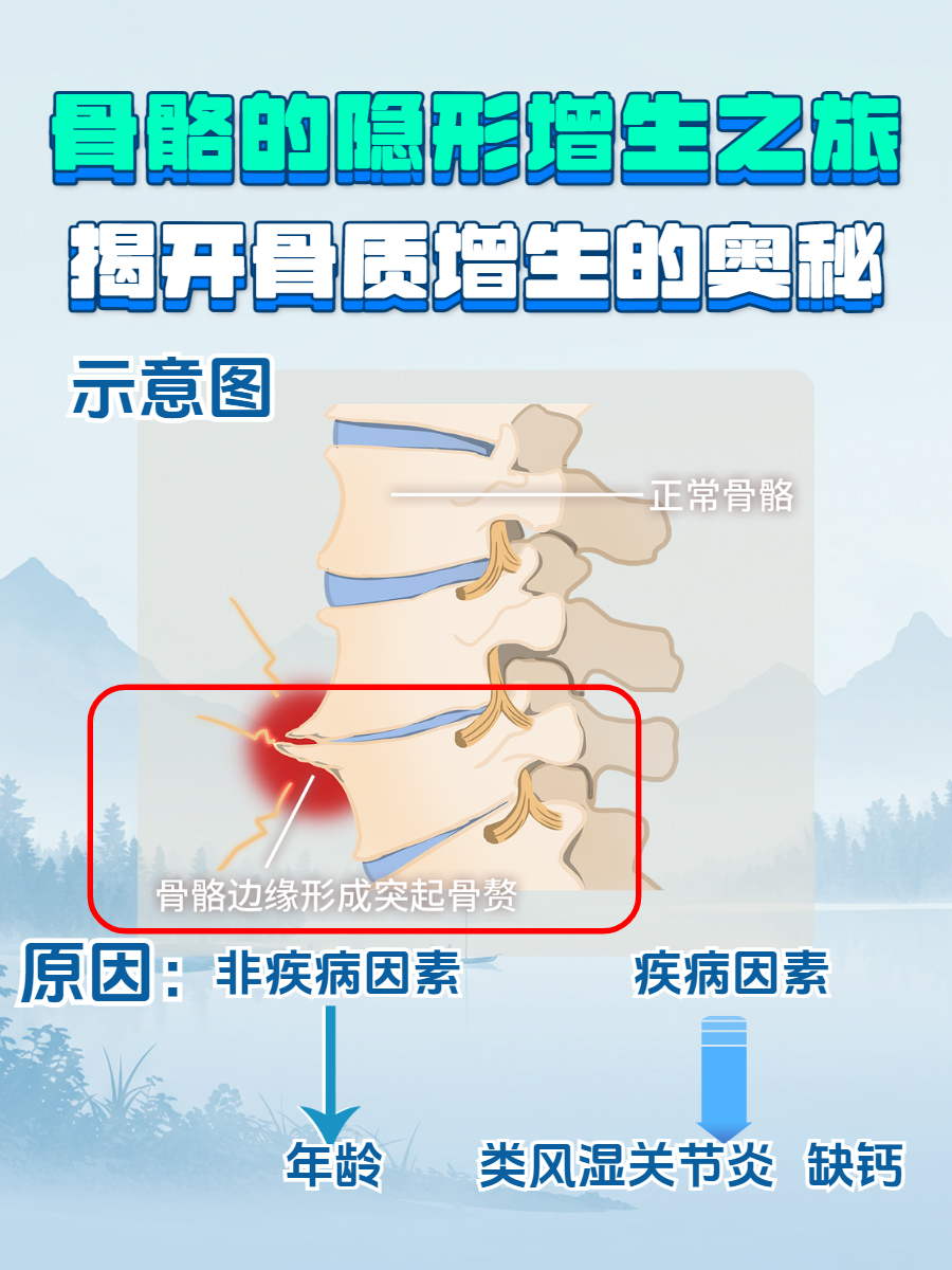 骨质增生是怎么造成的