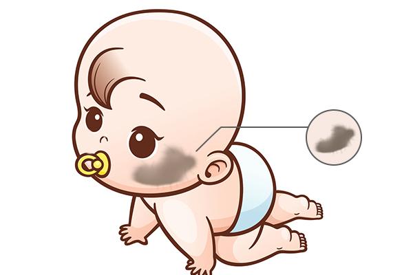 胎记是什么意思?