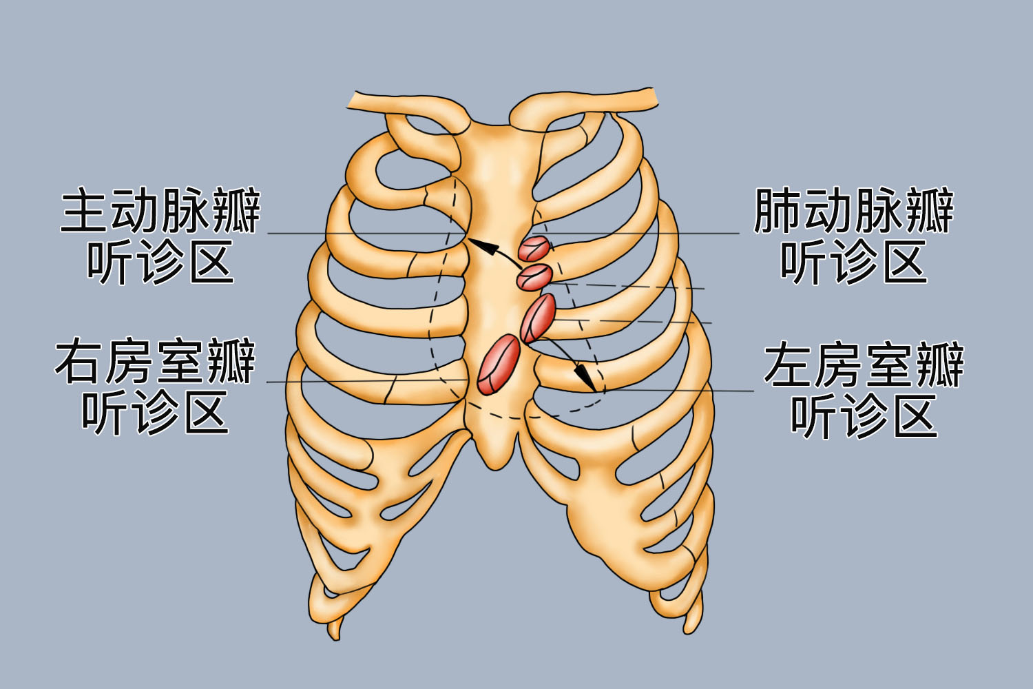 肺动脉瓣狭窄的表现